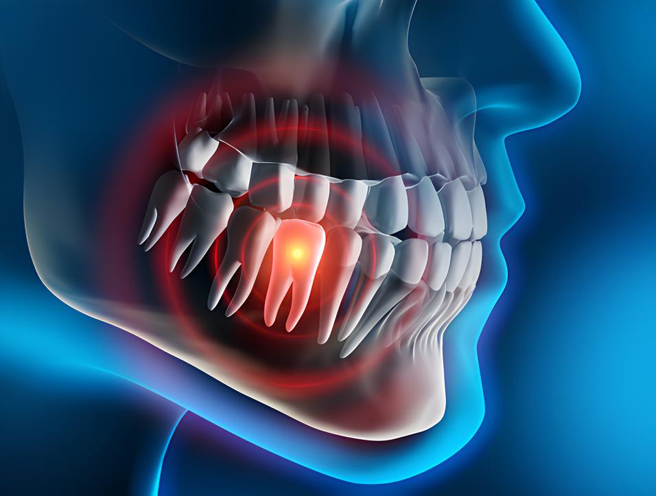 Teeth image - Emergency dentist Farnham